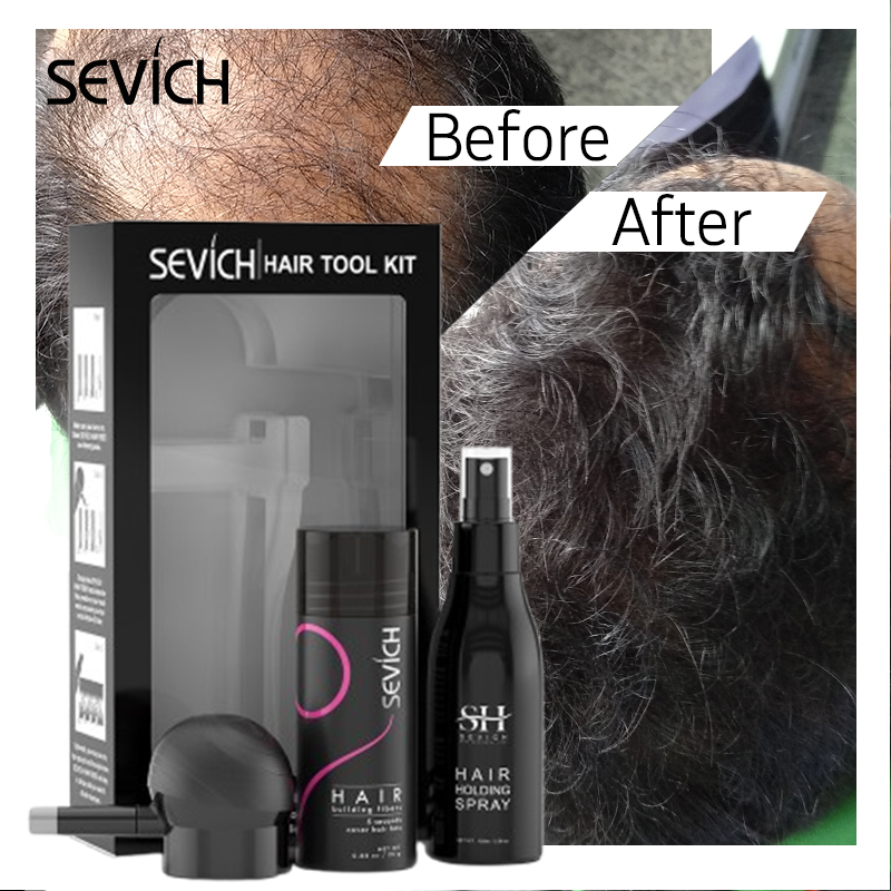 Keratin Treatment Set - 검은색 헤어 섬유 세트 모발 성장