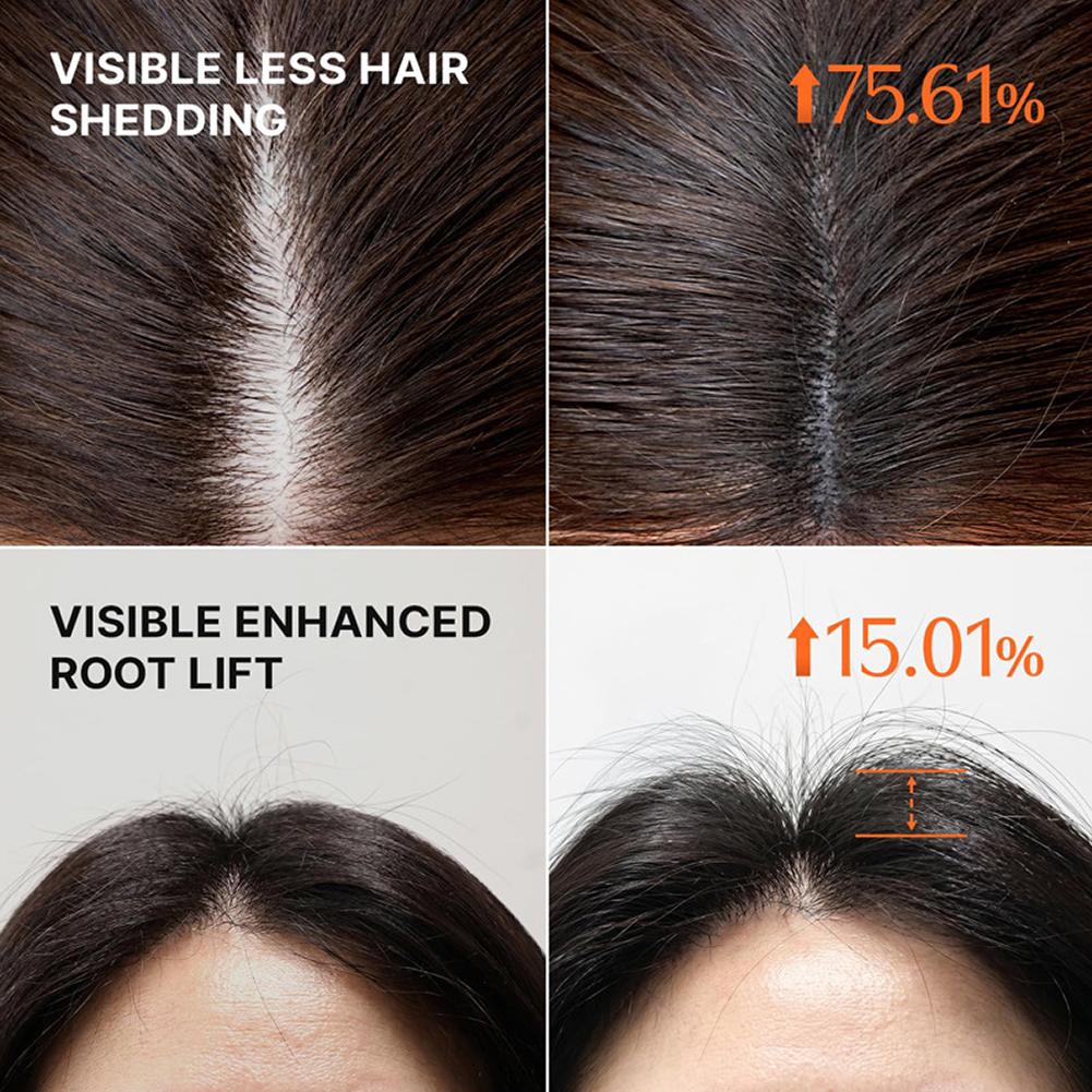 GROW:턴 3D 볼류마이징 샴푸 위드 엑소좀 콤 안티 - Hair Care For Hair Fall 리뷰 및 가격