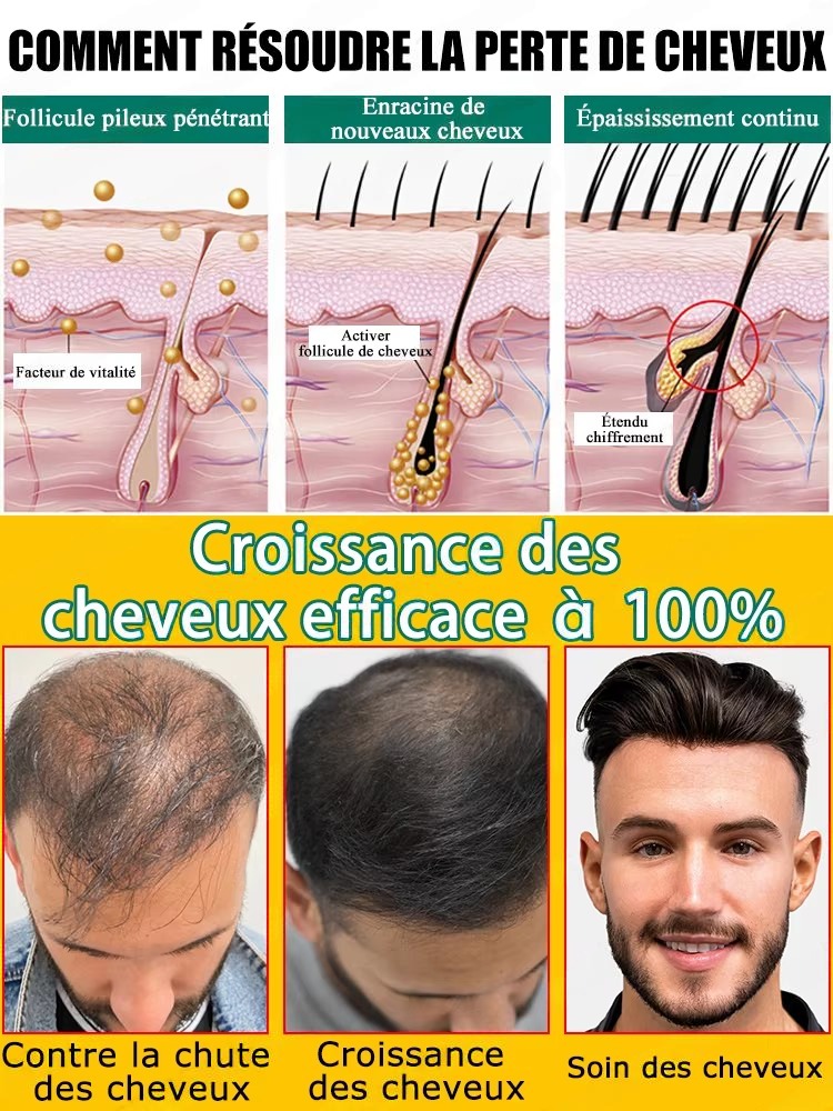 천연 생강 헤어 케어 에센스, 두피 피부를 탄탄하게,  - Hair Care For Hair Fall 리뷰 및 가격