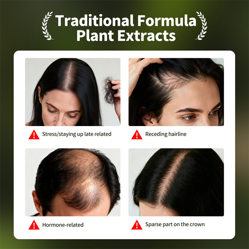 자연 모발 성장 세트 우스만 허브 샴푸 비누 허브 모발 - Hair Care Natural Products 리뷰 및 가격