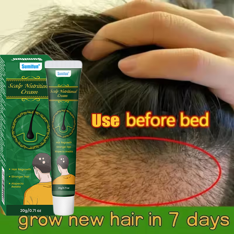 빠른 생강 모발 성장 크림 탈모 방지 대머리 복구 손상 - Hair Care Dupes 리뷰 및 가격