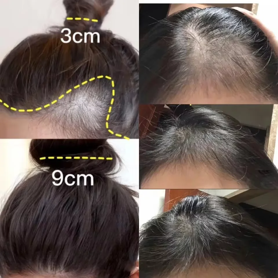 빠른 생강 모발 성장 크림 탈모 방지 대머리 복구 손상 - Hair Care Dupes 리뷰 및 가격