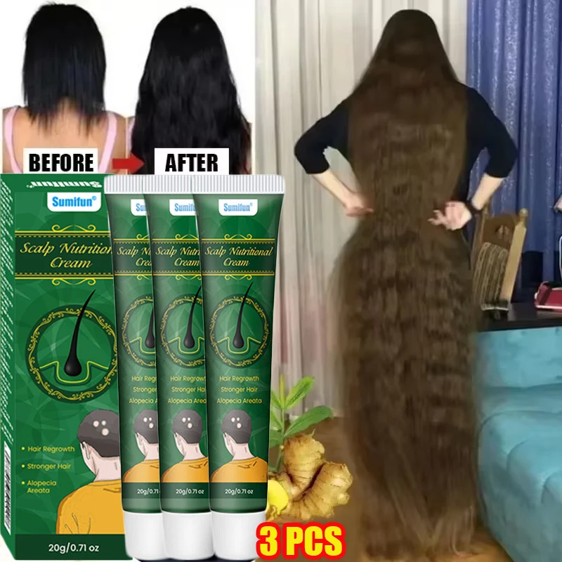 빠른 생강 모발 성장 크림 탈모 방지 대머리 복구 손상 - Hair Care Dupes 리뷰 및 가격