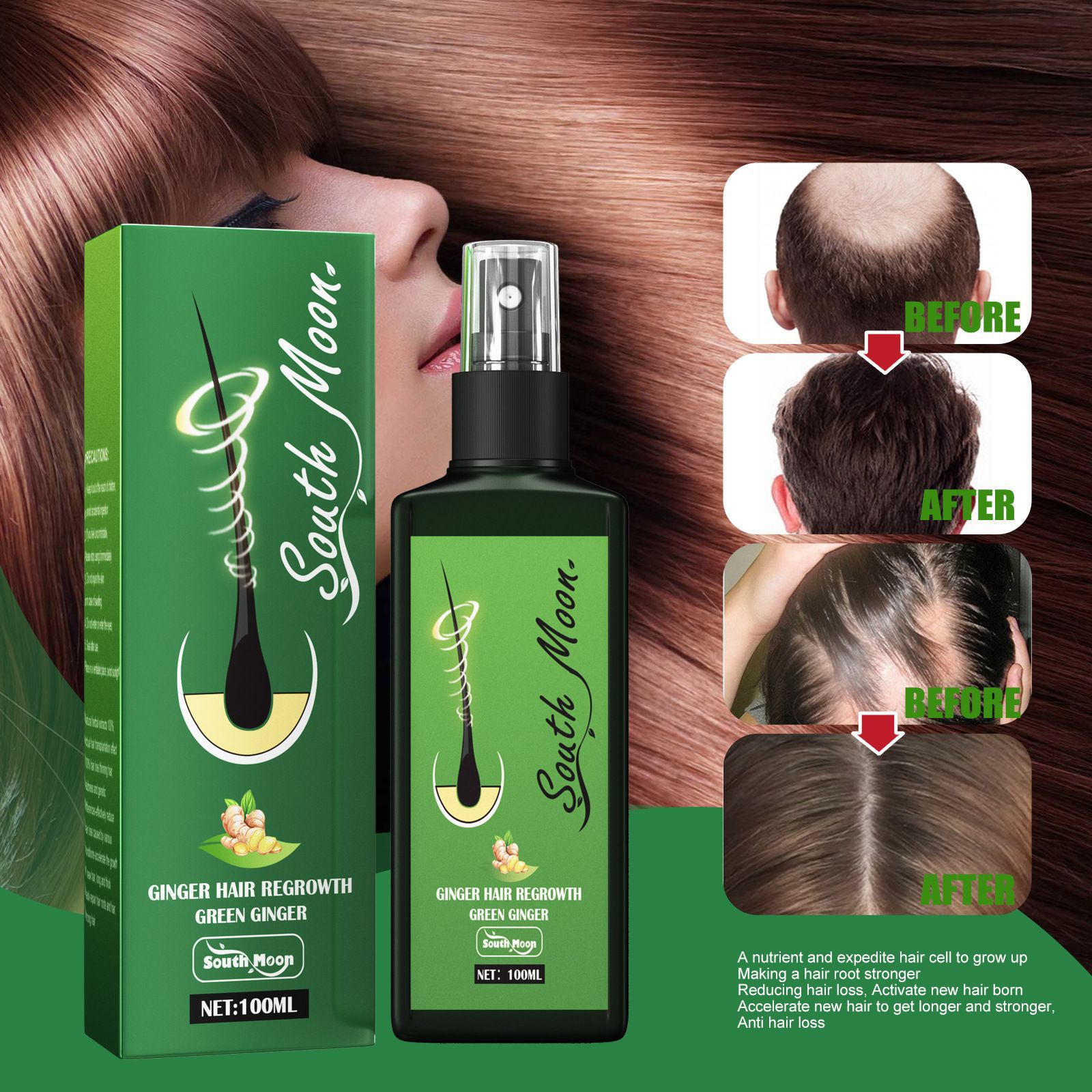 사우스 문 진저 헤어 그로우 스프레이 모근 강화 및 모 - Hair Care Natural Products 리뷰 및 가격