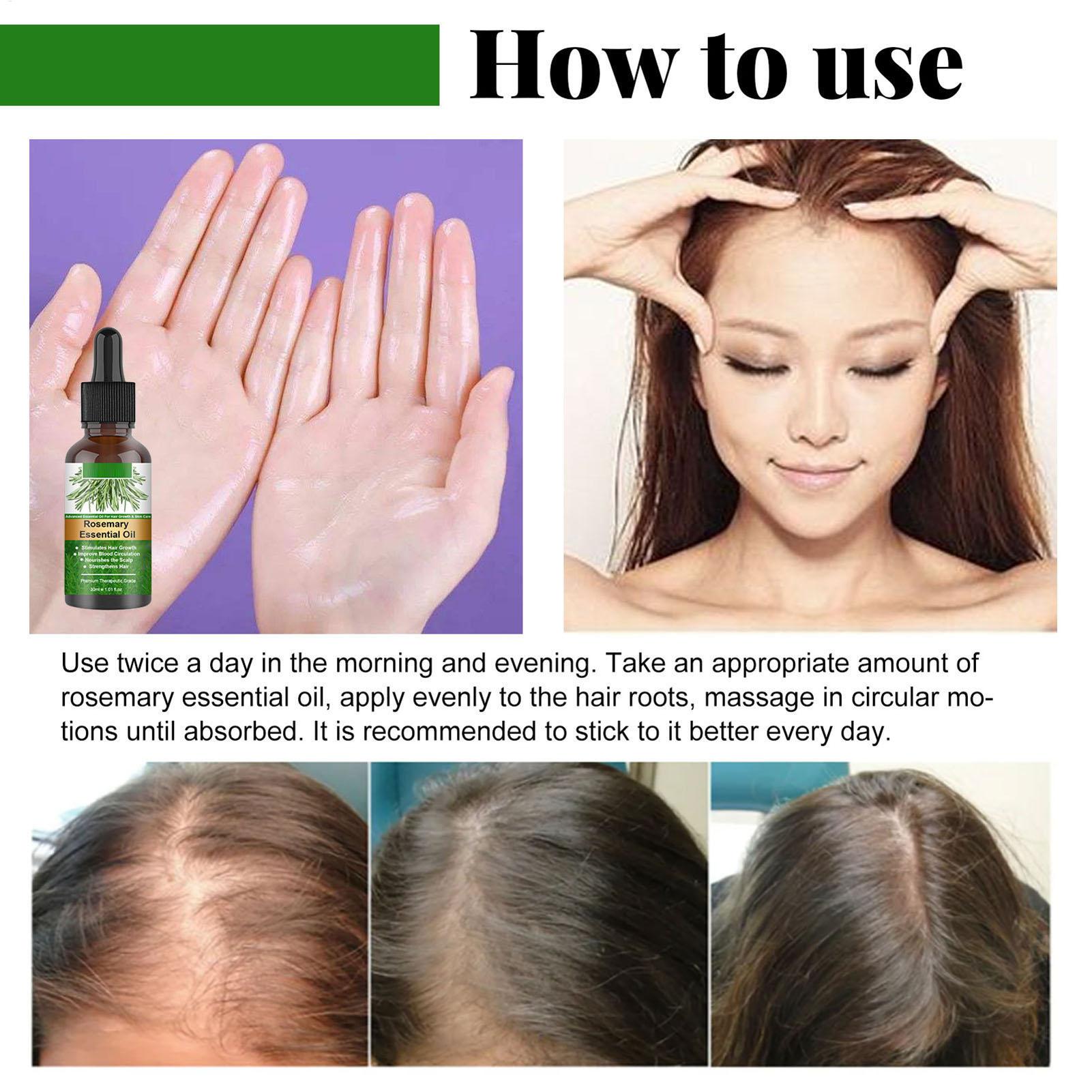로즈마리 에센셜 오일 헤어 성장 제품, 두피 모발 강화 - Hair Care Natural Products 리뷰 및 가격