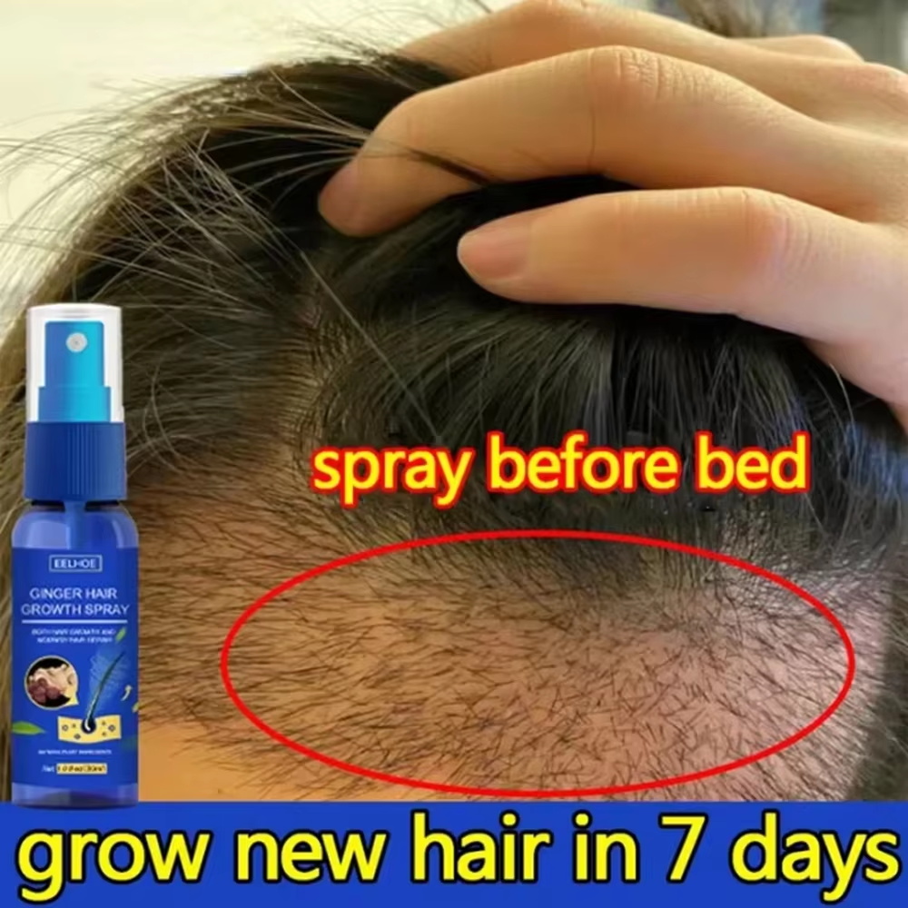 빠른 생강 모발 성장 스프레이, 모발 뿌리 강화, 탈모 - Hair Care Natural Products 리뷰 및 가격