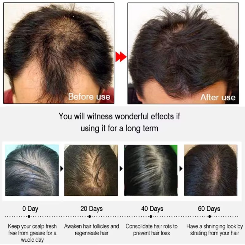 빠른 생강 모발 성장 스프레이, 모발 뿌리 강화, 탈모 - Hair Care Natural Products 리뷰 및 가격